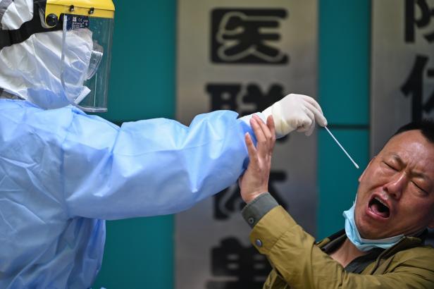 Ein Mann, der auf das neuartige Coronavirus COVID-19 getestet wird, reagiert, als ein medizinischer Mitarbeiter in Wuhan in der zentralen chinesischen Provinz Hubei eine Tupferprobe entnimmt. Ein Mann, der auf das neuartige Coronavirus COVID-19 getestet wird, reagiert, als ein medizinischer Mitarbeiter in Wuhan in der zentralen chinesischen Provinz Hubei eine Tupferprobe entnimmt.