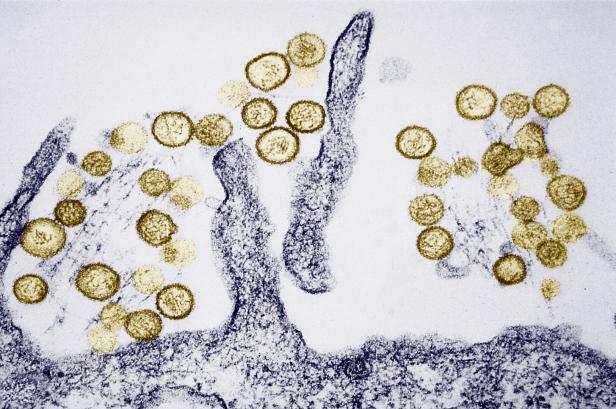 Sin Nombre Virus