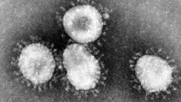 Der Corona-Virus unter dem Mikroskop