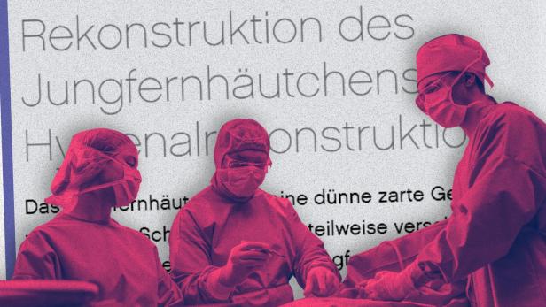 Drei Ärzt:innen an einem OP-Tisch, im Hintergrund ein Screenshot "Rekonstruktion des Jungfernhäutchens