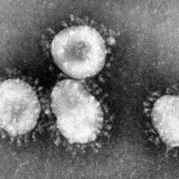 Der Corona-Virus unter dem Mikroskop