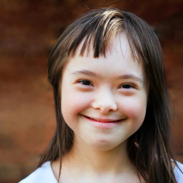 Österreich hinkt bei der Integration für Schüler mit Down-Syndrome nach.