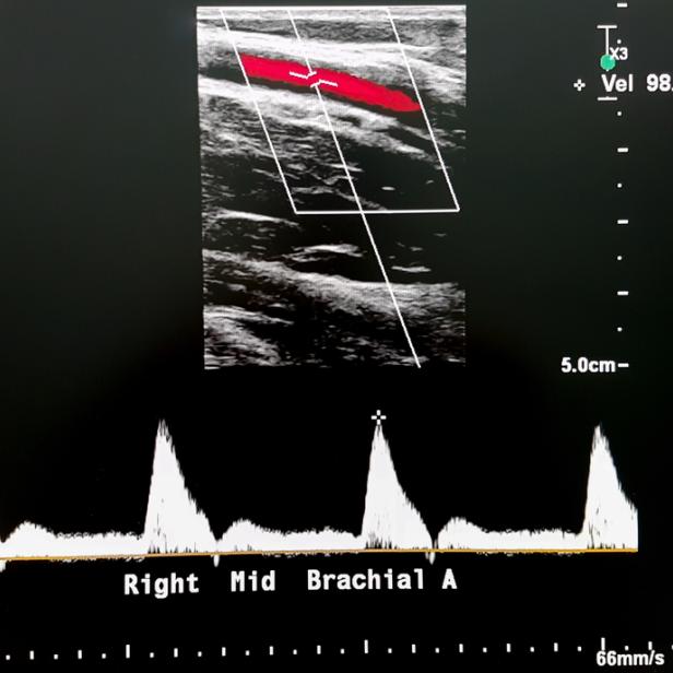 Die Dopplersonografie macht heute einen unverzichtbaren Teil der medizinischen Diagnostik aus