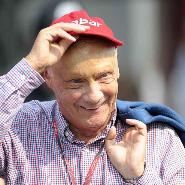 Niki Lauda hat seine neue Lunge im AKH Wien erhalten