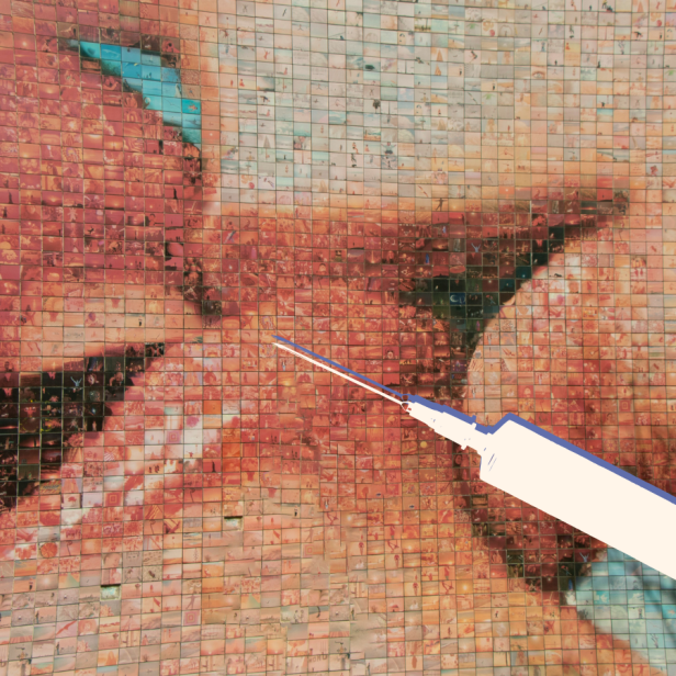 Lippen aufspritzen