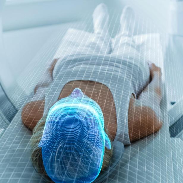 Eine Person liegt in einem Magnetresonanztomografen, wobei die Hirnaktivität aufgezeichnet wird.