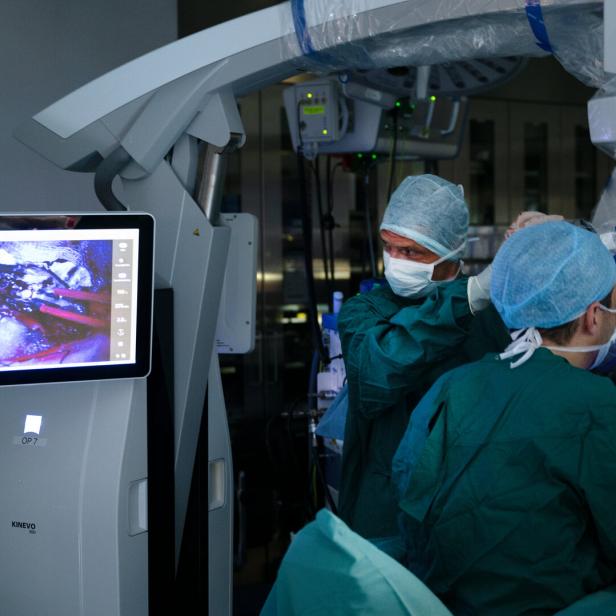 Ärzte in einem Operationssaal, auf einem Bildschirm ist eine Gehirn-Operation zu sehen. 