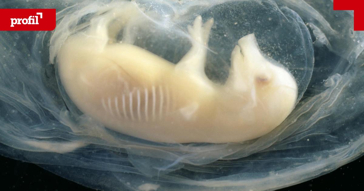 Menschenherz-im-Schweine-Embryo-Warum-Forschende-Mischwesen-erschaffen